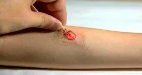 کمک تاتو الکترونیکی به سلامت افراد