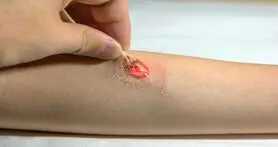 کمک تاتو الکترونیکی به سلامت افراد