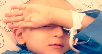 جایگزین شیمی درمانی در ایران معرفی شد