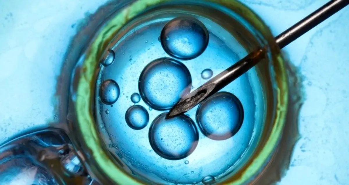 درمان جدید ناباروری که بسیار ارزان است