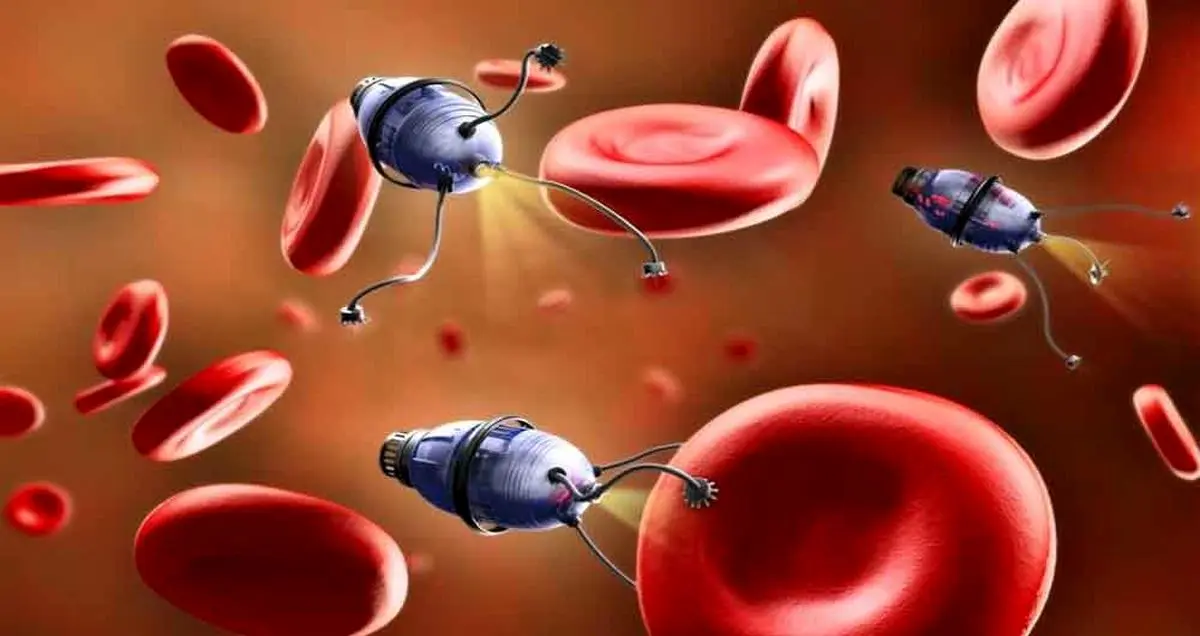 درمان افسردگی و صرع از طریق ارسال نانوربات به مغز