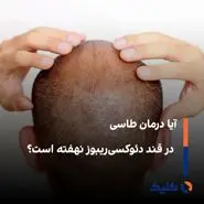 آیا درمان طاسی در قند دئوکسی‌ریبوز نهفته است؟