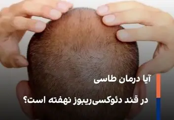 آیا درمان طاسی در قند دئوکسی‌ریبوز نهفته است؟