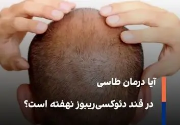 آیا درمان طاسی در قند دئوکسی‌ریبوز نهفته است؟