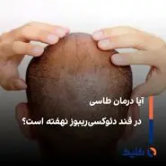 آیا درمان طاسی در قند دئوکسی‌ریبوز نهفته است؟