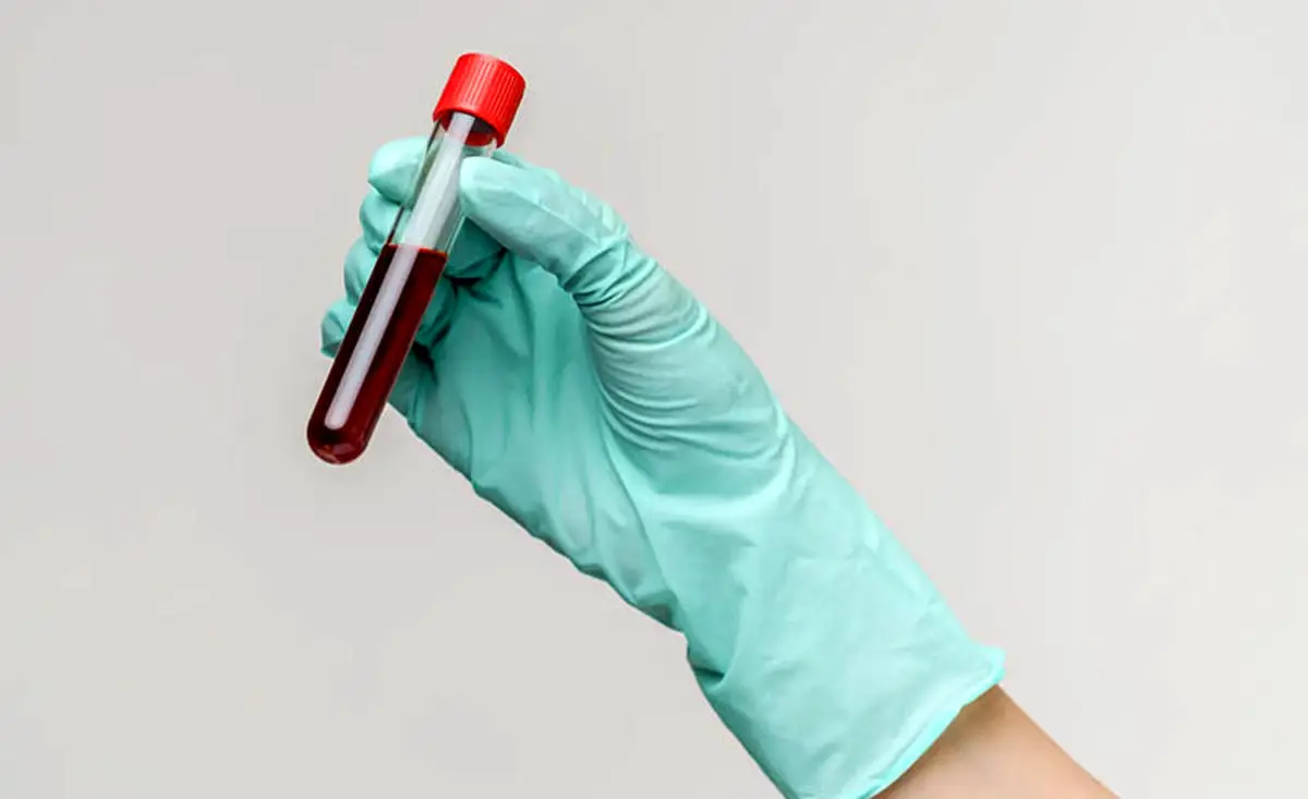 توسعه آزمایش خون سریع و ارزانی که می‌تواند سرطان را قبل از پیدایش علائم تشخیص دهد
