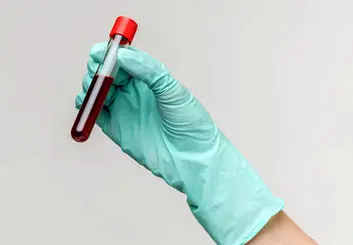 توسعه آزمایش خون سریع و ارزانی که می‌تواند سرطان را قبل از پیدایش علائم تشخیص دهد