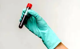 توسعه آزمایش خون سریع و ارزانی که می‌تواند سرطان را قبل از پیدایش علائم تشخیص دهد