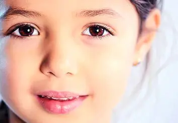 تشخیص اوتیسم از شبکیه چشم کودکان با دقت 100 درصدی توسط هوش مصنوعی 