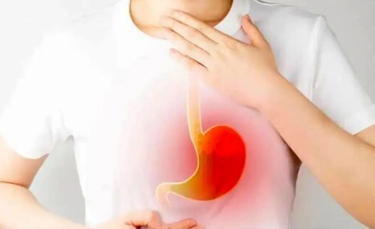 دانشمندان از هوش مصنوعی برای تولید نمونه بهتری از داروی کنترل اسید معده استفاده کردند