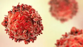 نانوذرات لیپیدی به کمک درمان سرطان خون می‌آید
