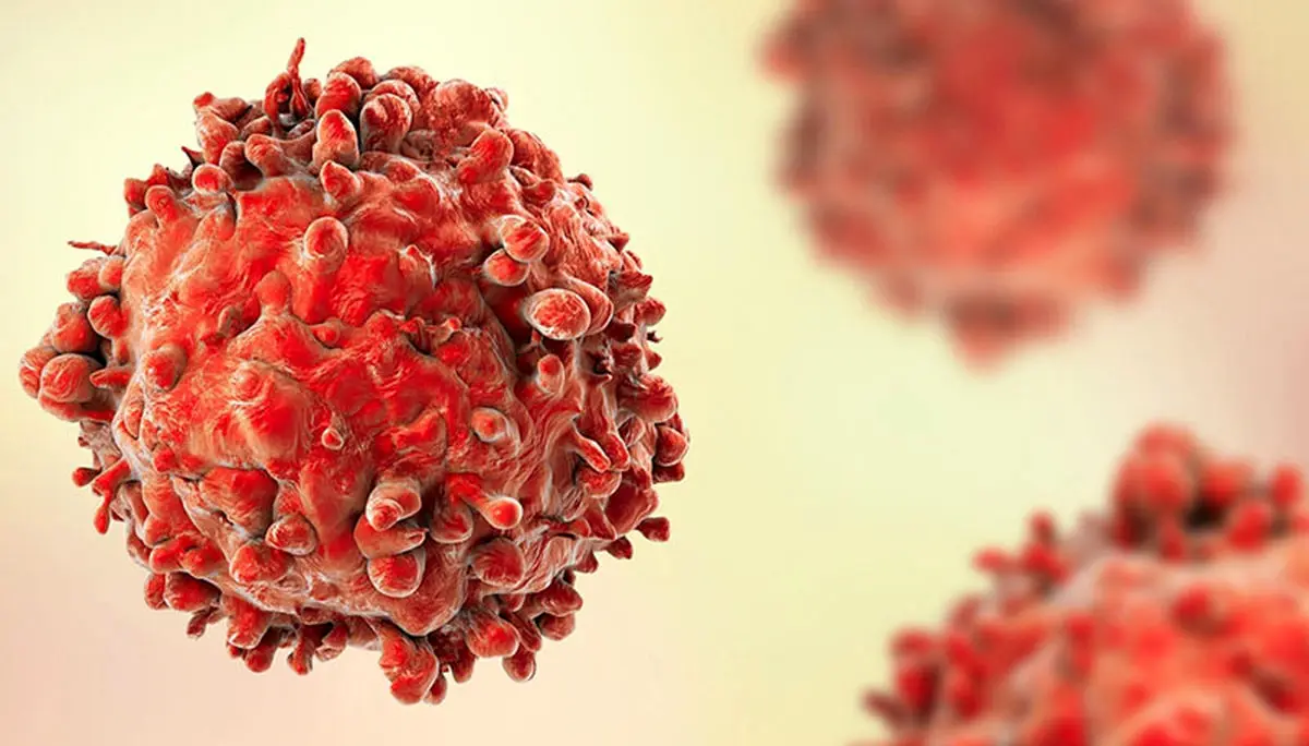 نانوذرات لیپیدی به کمک درمان سرطان خون می‌آید
