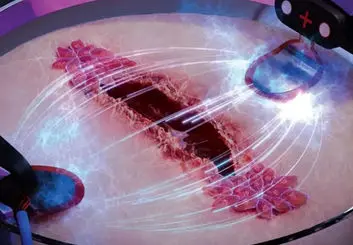 با الکتریسیته بدترین نوع زخم‌ها را درمان کنید!
