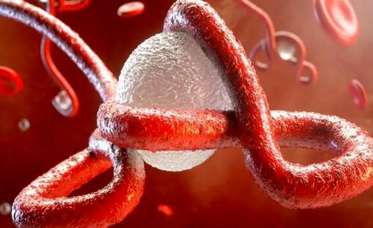 ویروسی که با ایجاد نانولوله‌ها بین‌ سلول‌ها مخفی شده و حرکت می‌کند
