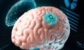 پیشگیری از اعتیاد به قمار با کاشت یک تراشه در مغز!
