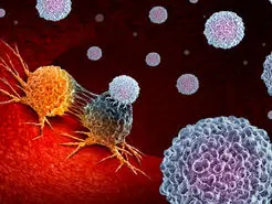 ایرانی‌ها راه حل درمان بدون بازگشت سرطان روده بزرگ را پیدا کردند
